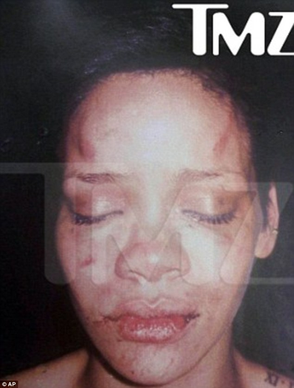 Chris Brown’s Timely Realization On Beating Rihanna